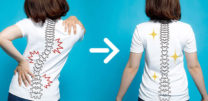 chiropractic for good posture in Lawrenceville GA